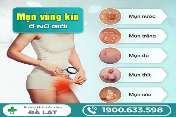 Hình ảnh minh họa